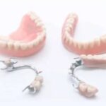 teljes fogpótlás Budaörs Dental