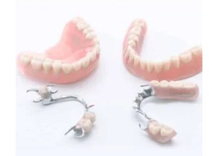teljes fogpótlás Budaörs Dental