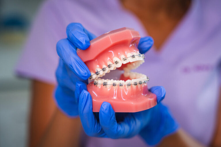 helyes fogmosás - Budaörs Dental