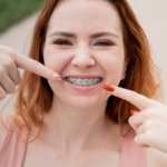 felnőtt fogszabályozás - Budaörs Dental