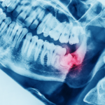 budaors-dental-cikk-bolcsessegfog